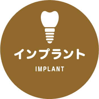 インプラント